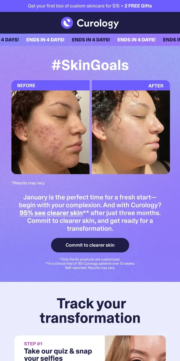 Email from Curology. Track your skincare transformation