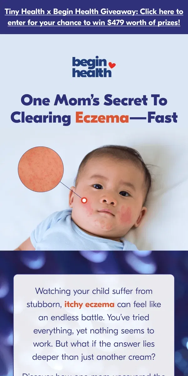 Email from Begin Health. Does your kiddo suffer from eczema?