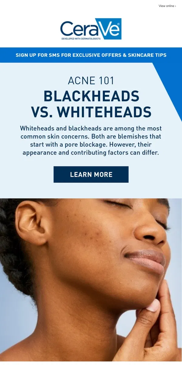 Email from CeraVe. Acne 101: Blackheads vs Whiteheads