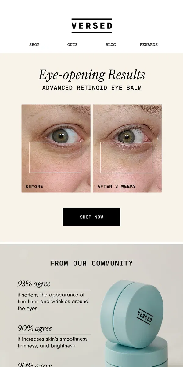 Email from Versed Skin. Brighter, smoother undereyes